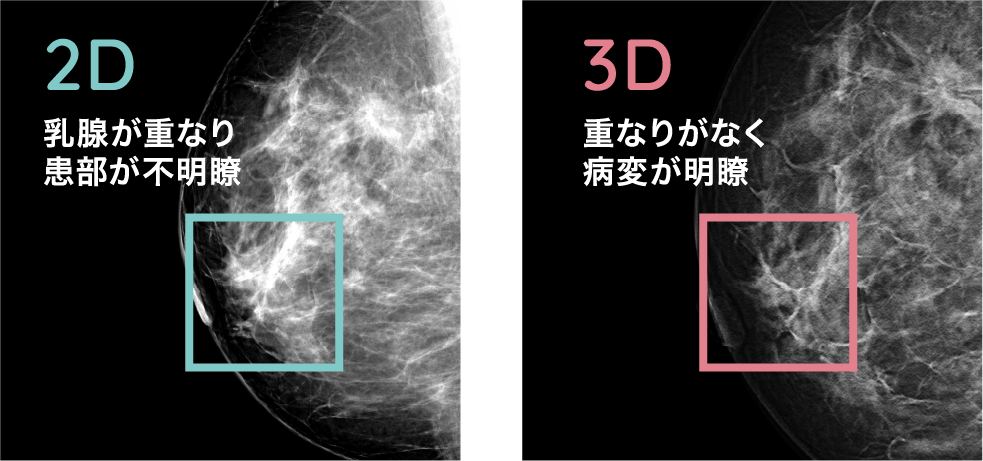 トモシンセスとは